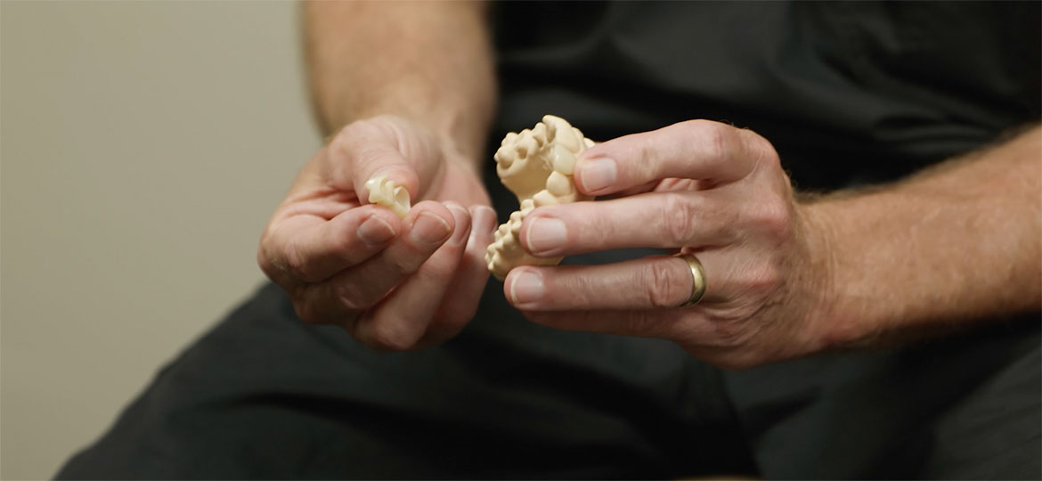 Lebanon In Dental Bridge Dentist